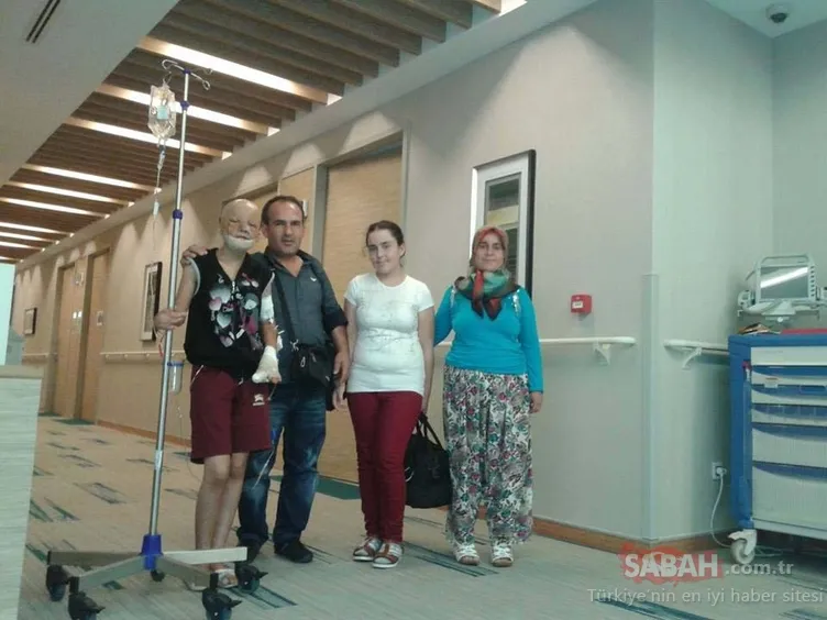 20 yıllık zorlu mücadele ve mutlu son: 49 ameliyatla yeni yüz