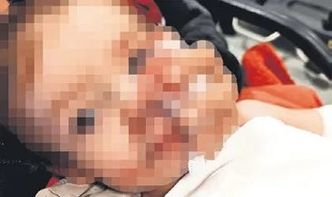 Apartmanda pitbull dehşeti