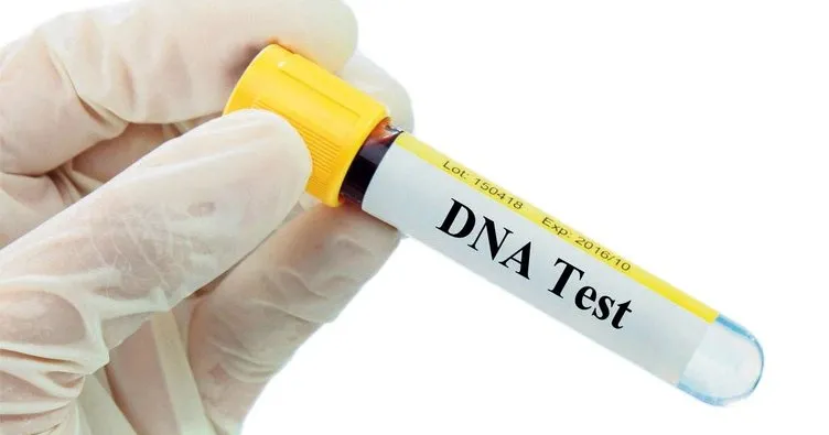 186 milyon TL’lik DNA testi