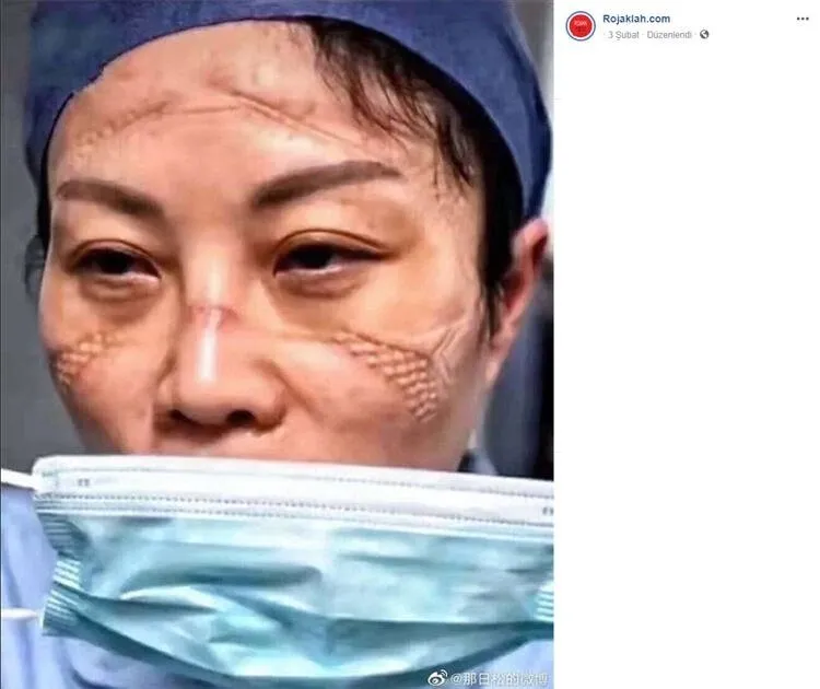 Koronavirüs ile mücadelenin izleri günlerce konuşulmuştu! Acı haberi duyurdular