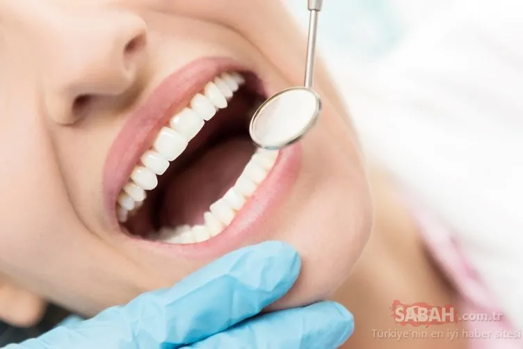 20 dakikada diş beyazlatma yöntemine çok şaşıracaksınız!