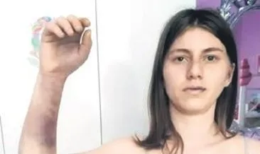 Beyzbol sopası silah sayıldı, ceza 2.5 kat arttı #izmir