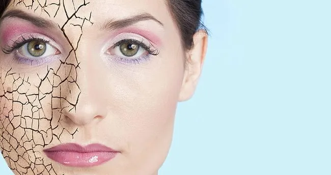 cilt kurulugu neden olur cildin