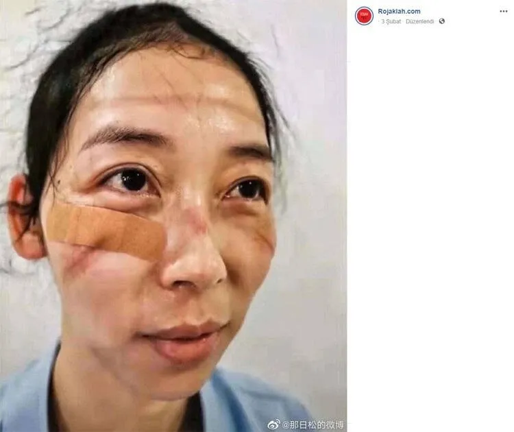 Koronavirüs ile mücadelenin izleri günlerce konuşulmuştu! Acı haberi duyurdular