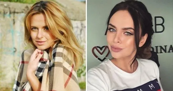 Rus kadınlarının estetikle değişimi