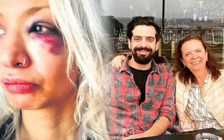 Gitarist Can Tunaboylu’nun şiddet uyguladığı Aybike Çelik GÜNAYDIN’a konuştu Aydın sanatçı değil empati yoksunu bir kadın