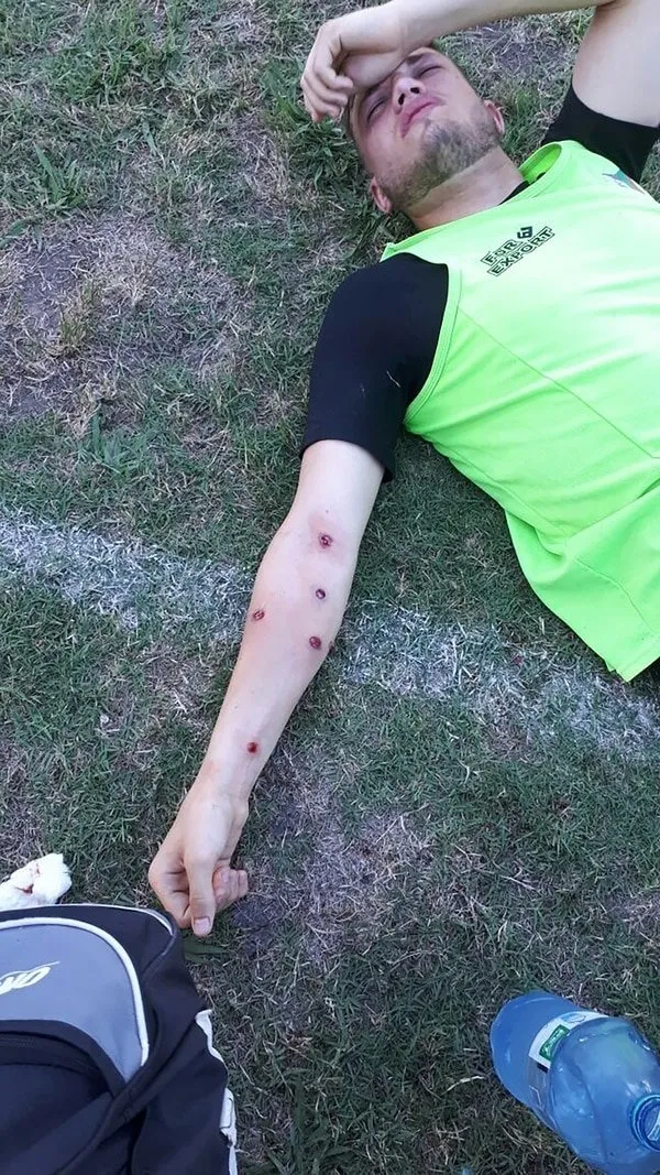 Futbolculara plastik mermi sıktılar!