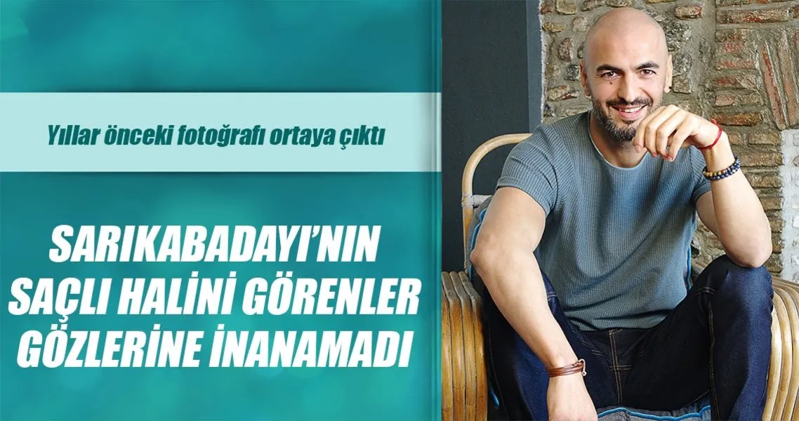 soner sarikabadayi nin sacli hali soke etti son dakika magazin haberleri