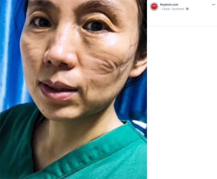 Koronavirüs ile mücadelenin izleri günlerce konuşulmuştu! Acı haberi duyurdular