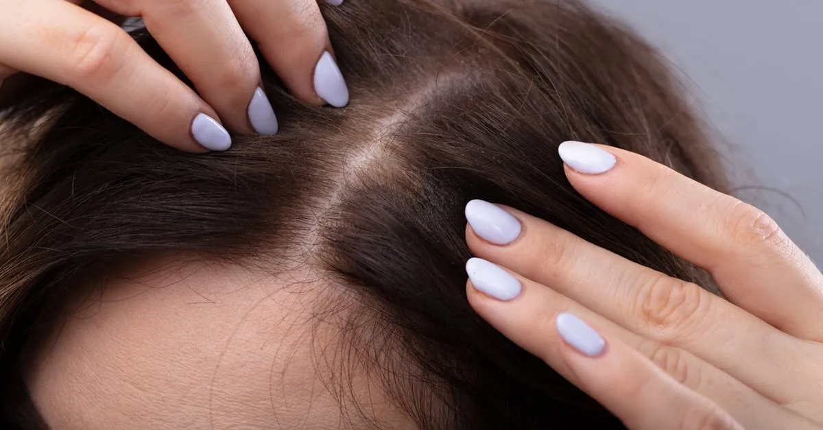 kafada sivilce cikmasi neden olur sac diplerindeki sivilce ve benzeri sislikler evde tedavi ile nasil gecer guzellik haberleri