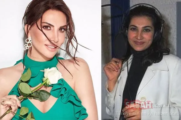 Estetik operasyonlarla bambaşka birine dönüşen ünlüler!