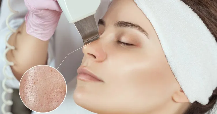 Göz çevresindeki yağ bezelerine dikkat !