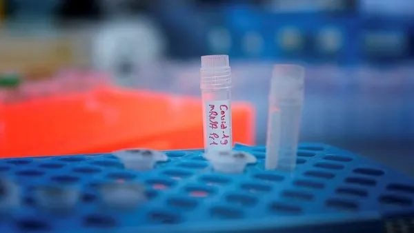 https www sabah com tr saglik 2020 04 24 bobrek rahatsizliklarinin 10 belirtisi