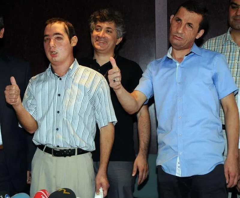 Turan Çolak yeni yüzünü ilk kez gördü Son Dakika Haberler