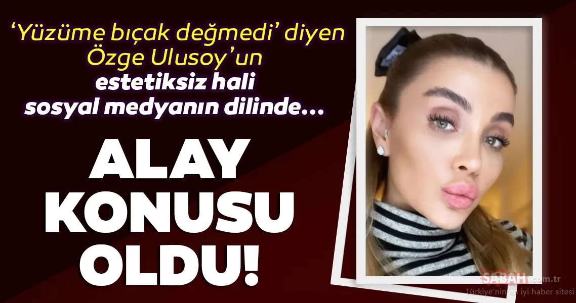 Özge Ulusoy �Estetiğim yok� dedi eski hali alay konusu oldu! Özge