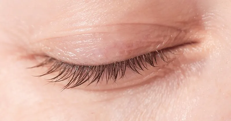 Goz Kizarikliginin Sebepleri Nelerdir Goz Kanlanmasinin Nedenleri Saglik Haberleri Goz Kizarikliginin Sebepleri Nelerdir Goz Kanlanmasinin Nedenleri Saglik Haberleri