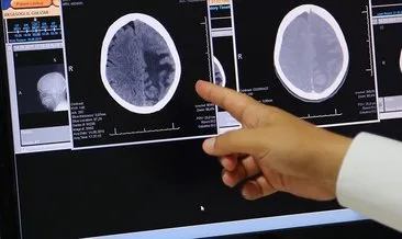 ’Türk Beyin Projesi’nin tamamlanmasıyla beyin tümörü sınıflandırması yapabiliyoruz’