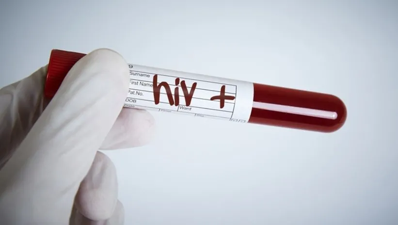 AIDS TEDAVİ EDİLİR Mİ? AIDS HIV TEDAVİSİ VAR MI, TAMAMEN DÜZELİR Mİ?