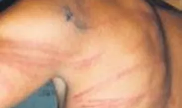 16 yaşındaki çocuğa işkence dehşeti