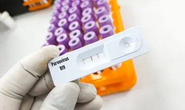 Parvovirus B19 salgınına karşı uyarı!  Baharda pik yapması bekleniyor! Bu kişiler risk altında…