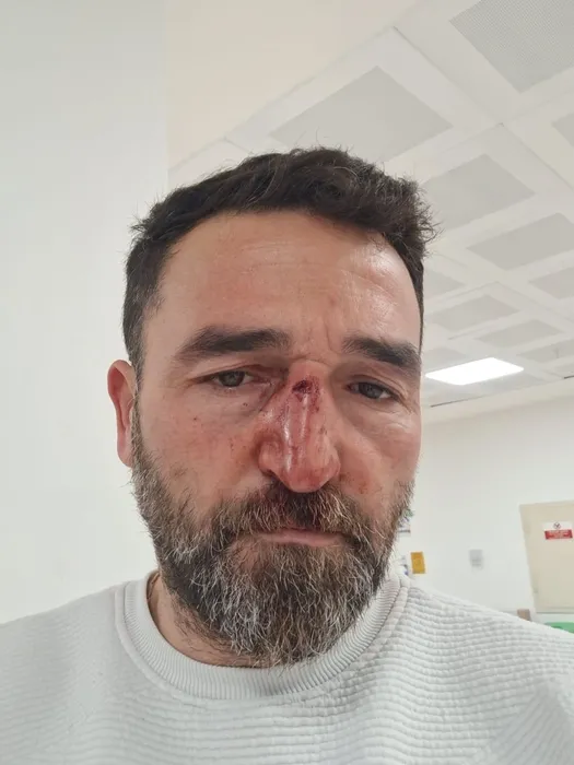 İstanbul’da emlakçıya öyle şeyler yaptılar ki... ’Şerefsizlik yapma, öldürürüm’