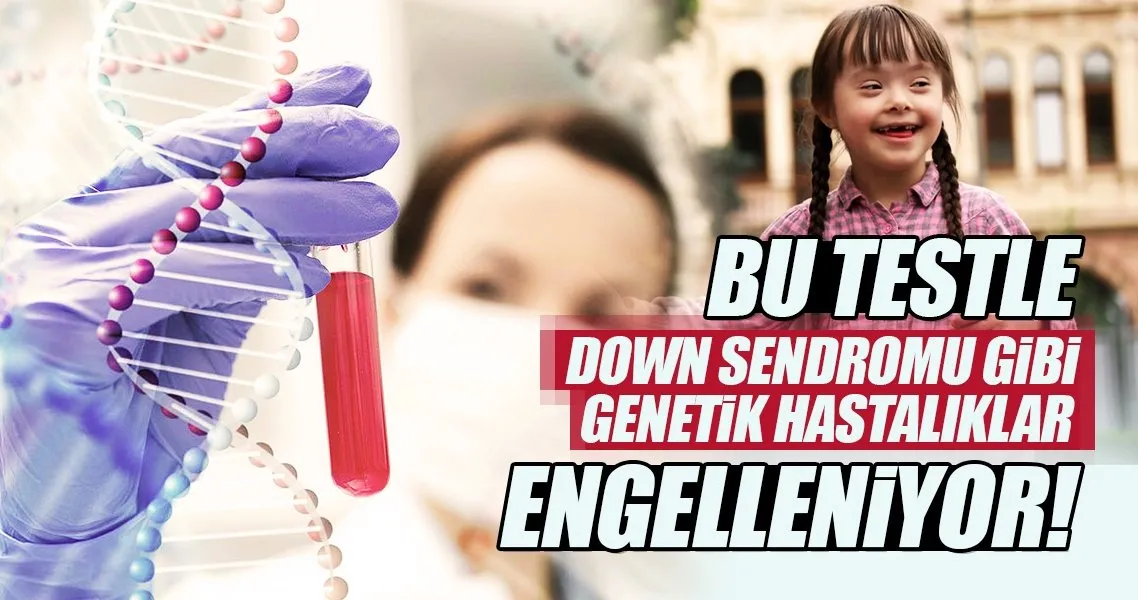 O Test Ile Down Sendromu Daha Embriyoyken Engelleniyor Son Dakika Haberler