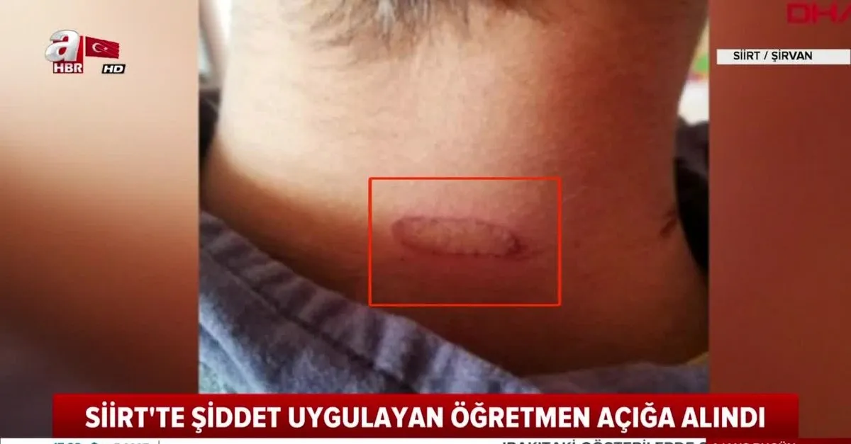 Siirt Te Sinifta Ogrencilere Kizgin Masali Iskence Videosunu Izle Sabah Tv