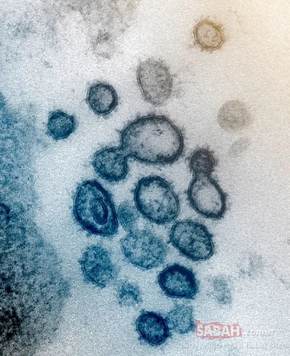 İşte koronavirüsün bulaşacağı en riskli alanlar...