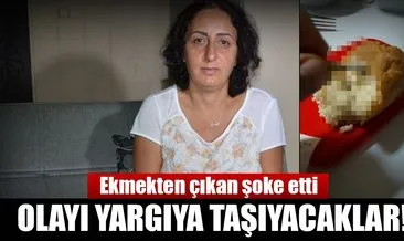 Marketten aldığı ekmek dişini kırdı