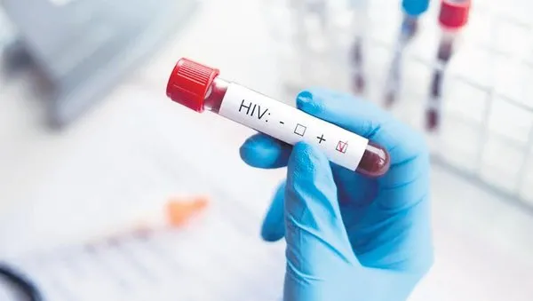 hiv-pandemisi-dakikada-1-kisi-hivden-oluyor-1732635401606.jpeg
