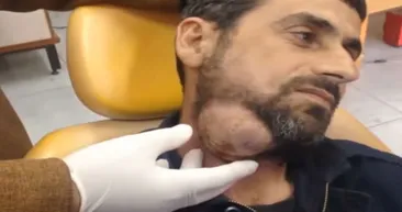 Adamın boynundan çıkanlar şaşırttı!