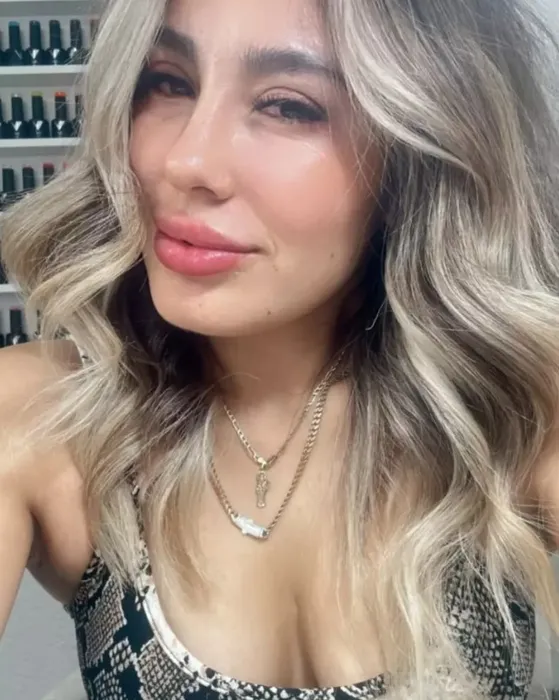 Tırnak tasarımcısı güzellik uğruna canından oldu! Asli Fernández’in geçirdiği operasyon duyanları şoke etti!