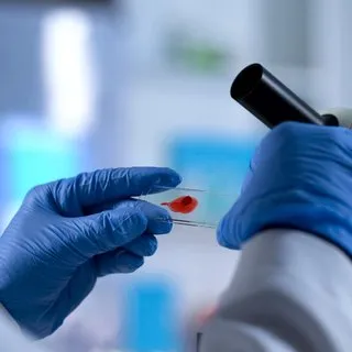HIV kontrol altında tutulabiliyor