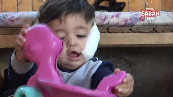 Antalya'da pitbull dehşeti! 11 aylık bebeğin yanağını ve kulağını kopardı, babasını metrelerce sürükledi | Video