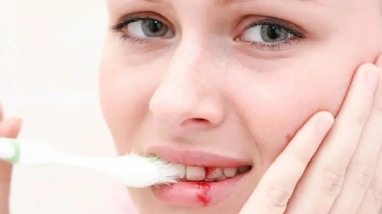 Diş fırçalarken bir kanama görüyorsanız!