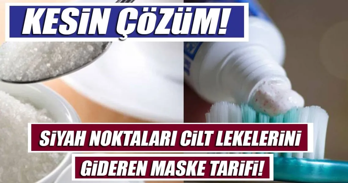 siyah noktalari ve cilt lekelerini tuz