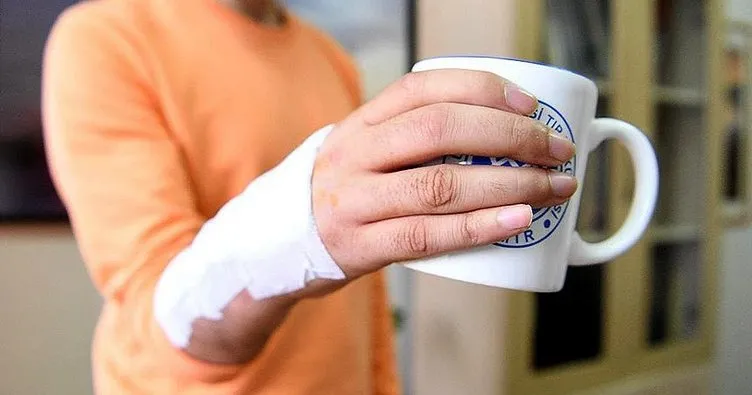 Ege Üniversitesi’nde el bileği protezi geliştirildi