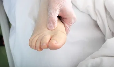 Mucize gıdalar! Vücutta ödem bırakmıyor