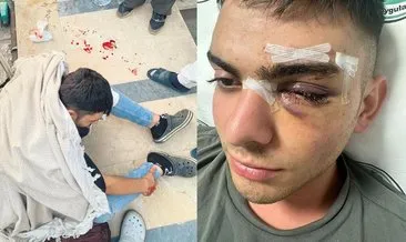 Servis çalışanını döve döve hastanelik ettiler #kocaeli