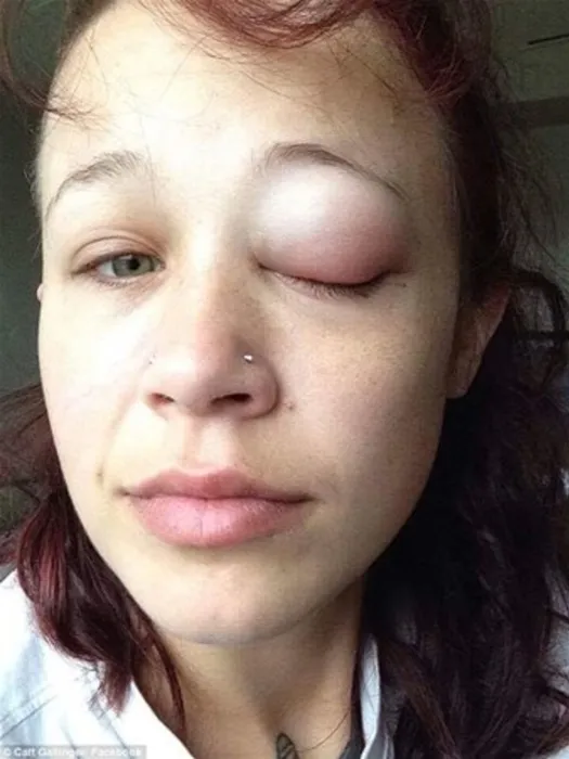 Dövme yaptırdılar sonucu bakın ne oldu!