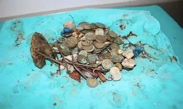 Midesinden 83 liralık madeni para çıktı