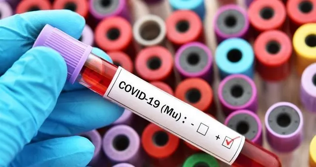 mu mutasyonu hangi ulkelerde goruldu mu varyanti nedir mu variant belirtileri neler mu varyanti turkiye de kac kiside goruldu son dakika spor haberleri mu mutasyonu hangi ulkelerde goruldu mu varyanti nedir mu variant belirtileri neler mu varyanti turkiye de kac kiside goruldu son dakika spor haberleri