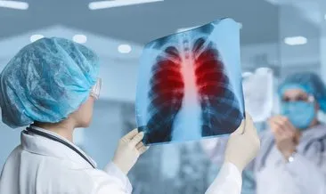 Akciğerleri çürütüyor dikkat! Bu hastalığa yakalananların %20’si hayatını kaybediyor...