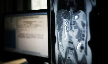 Karaciğer sağlığı için 10 ipucu