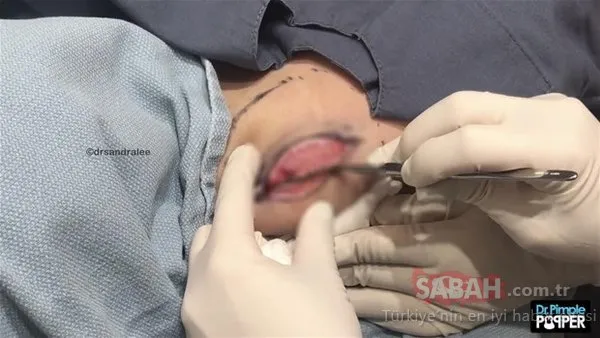 Operasyonla aldırdı gözlerine inanamadı!