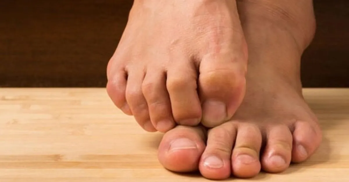 ayak mantari nasil gecer ne iyi gelir ayak basparmak tirnak mantari tedavisi saglik haberleri