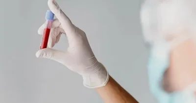 Bu kan grubuna sahip olanlarda erken dönem felç ihtimali daha yüksek! Uzmanlar uyardı!