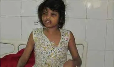 Hindistan’da maymunlarla yaşayan kız çocuğu bulundu