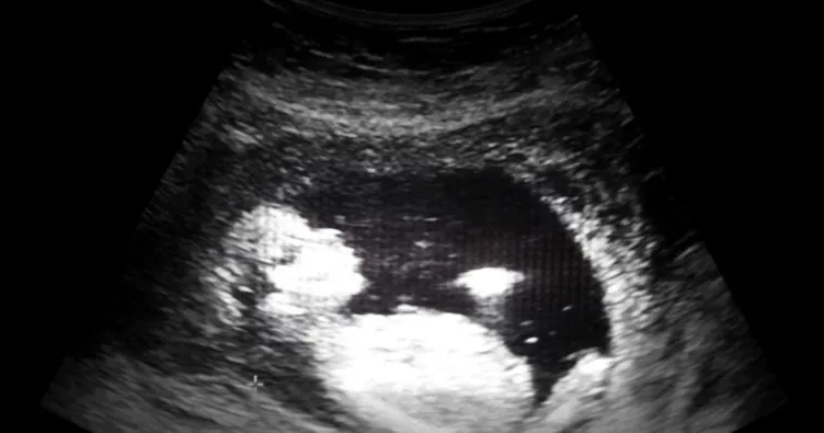 ABD’de ölen doktorun evinde 2 binden fazla fetüs bulundu