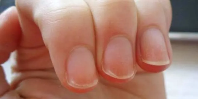 Akciğer kanserinin 10 belirtisi